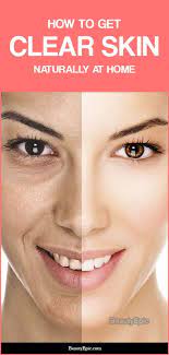 How To Get Clear Skin Naturally At Home Clear Skin Remedies Clear Skin Naturally Natural Skin Care