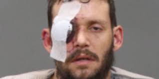 Woman helps man under attack by hitting attackers with beer bottle