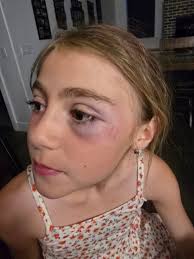 Looking for a team for my daughter to play on. She is 11- pitches and plays  shortstop. Would love to stay closer to Caldwell/nampa area