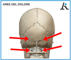 Dolore Alla Nuca Come Risolvere Un Sintomo Spesso Legato Alla Cervicale L Altra Riabilitazione