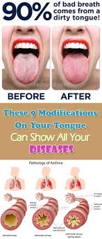 These 9 Modifications On Your Tongue Can Show All Your Diseases Tongue Health Natural Health Health