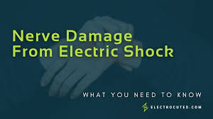 Nerve Damage From Electric Shock: What You Need To Know