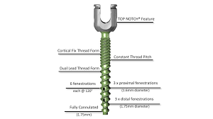 Viper Cortical Fix Fenestrated Screw System J J Medical