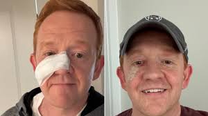 Spectrum News' Lee Ringer returning to TV after skin cancer