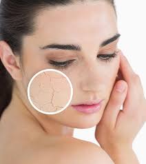 Image result for Dry Skin