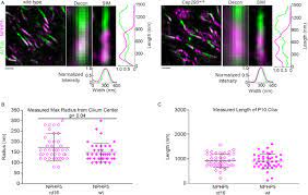 Check spelling or type a new query. Superresolution Microscopy Reveals Photoreceptor Specific Subciliary Location And Function Of Cep290 Biorxiv