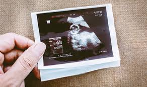 Why should you have an ultrasound at 7 weeks? Routine Ultrasound Pregnancy Info