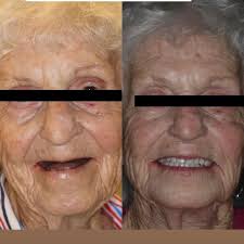 Jon Runion DDS (@jonruniondds) • Instagram photos and videos