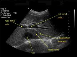 Ab 4 Png 580 430 Medical Ultrasound Ultrasound Diagnostic Medical Sonography