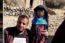يا عم لقد أسرعتَ في مسيرك حتى عَمِيَ عليّ طريقك وطفقت أبحث عنك فلم أجدك فرجعت إلى السوق لعليّ أعثر عليك ، والحمد لله أني وجدتك. Ø¨ÙŠØ¹ Ø§Ù„Ø·ÙÙ„Ø© Ù„ÙŠÙ…ÙˆÙ† ÙŠØµØ¯Ù… Ø§Ù„ÙŠÙ…Ù†ÙŠÙŠÙ† ÙˆØ§Ù„Ø¯Ù‡Ø§ Ø³Ù„ Ù…Ù‡Ø§ Ù„Ø´Ø§Ø¨ Ù…Ù‚Ø§Ø¨Ù„ 300 Ø¯ÙˆÙ„Ø§Ø± ÙˆØ­Ù…Ù„Ø© Ø¥Ù„ÙƒØªØ±ÙˆÙ†ÙŠØ© Øª Ø¹ÙŠØ¯Ù‡Ø§ Ø¥Ù„Ù‰ Ù…Ù†Ø²Ù„Ù‡Ø§ Ø¹ÙŠÙ† Ø§Ù„Ø§Ø±Ø¯Ù†