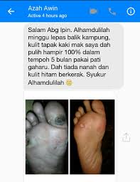 Kencing manis semasa mengandung adalah perkara normal tetapi apakah cara terbaik untuk kurangkannya agar kehamilan lebih baik dan selamat? Sembuh Luka Diabetes Dan Kencing Manis Malaysia Premium Gaharu Perfume