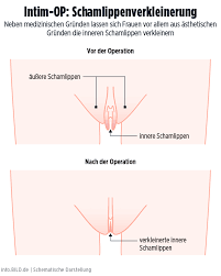 Im zusammenhang mit den berichten wurde in der ethnologischen literatur der ersten hälfte des 19. Schleimhautschwund Pilz Herpes Die 13 Grossten Gefahren Fur Die Vagina Bildplus Inhalt Gesundheit Bild De