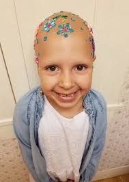 The condition is one in which the body's immune system actually attacks the hair follicles causing a significant loss of hair all at once. 14 Children With Hair Loss Ideas Hair Loss Hair Children