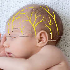 Image result for Forehead Regional Block