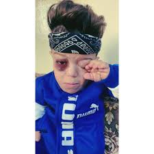 Injury and Concern from Friends