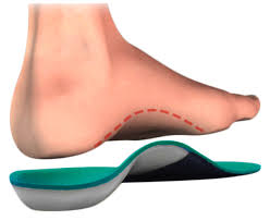 как избавиться от звона в ушах в домашних условиях Pin On Custom Orthotic