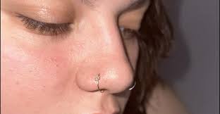 Gentle toner or exfoliator for t-zone congestion?