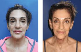 Prashant Soni Gallery