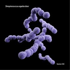 Image result for Group B Streptococcus Prophylaxis