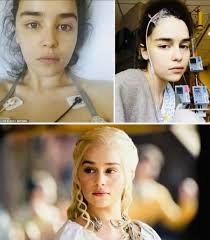 Man's hand reattached after injury