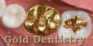 Check spelling or type a new query. Gold Crowns And Fillings