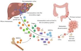 How fast/slow does colon cancer grow? Ijms Free Full Text Therapeutic Targeting Of The Tumour Microenvironment In Metastatic Colorectal Cancer