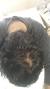 Healthy Crown Hair