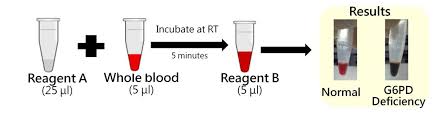 Image result for G6PD Deficiency Detection