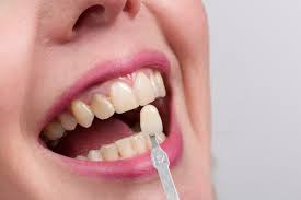 Tedavide sürecinde, implant diş fiyatları açısından kliniklerin ve kullanılan metal diş köklerinin çok büyük bir önemi vardır. Dusen Porselen Kuronumu Kendim Yapistirabilir Miyim Onur Ozturk