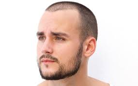 But you're not follicularly effed, so to speak. How To Effectively Fix A Patchy Beard Bald Spot Beardoholic