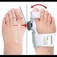 Image result for vybočený palec ortéza