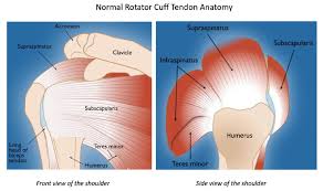 Image result for Rotator Cuff Rupture