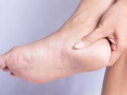 10 Penyakit Yang Bisa Dilihat Dari Kaki Apa Saja