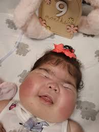 The first time Brenda and Vang held their baby girl Gracelyn, they were  expecting it to be their last. But within just an hour of kangaroo care,  Gracelyn's vitals improved, and she