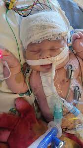What help and support can I get for my baby girl with a heart defect in Dane County?
