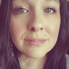 Good evening, Doctors are decreasing the sedation and Katiann is somewhat  alert! She has a lot of pain! She has been running a fairly high temp and  she has pneumonia, but it