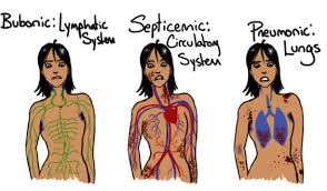 Symptoms - The Black Death