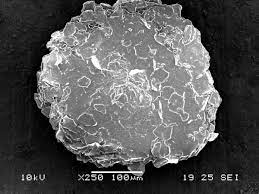 Symptoms include flaking and sometimes mild itchiness. Dandruff Wikipedia