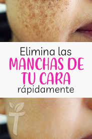 Eliminar las manchas en la piel por el sol. Como Eliminar Manchas En La Cara En Minutos Como Quitar Las Manchas En La Piel Manchas Roj Quitar Manchas Cara Manchas Marrones En La Piel Manchas En La Cara