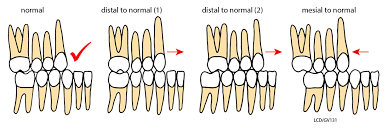 the teeth of the german shepherd dog the german shepherd dog