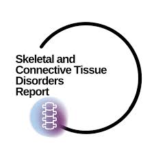 Image result for Connective Tissue Disorder