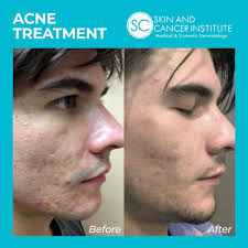 THE BEST 10 DERMATOLOGISTS near QUEEN CREEK, AZ 85142