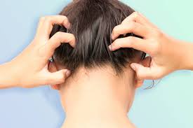 Also known as ringworm of the scalp, tinea capitis is a fungal infection that penetrates deep into the hair shaft, causing itchiness and hair loss. Why You Have An Itchy Scalp The Best Treatments Shampoos Glamour Uk