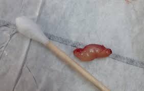 Nasal steroid sprays might help, too, if your sinus symptoms are due to allergies. Feline Oronasopharyngeal Polyp Virtuavet
