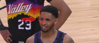 Cameron payne born 8th august 1994, currently him 26. Who Beat Up Cameron Payne Social Media Reacts To Cameron Payne Black Eye During Suns Vs Lakers Jordanthrilla