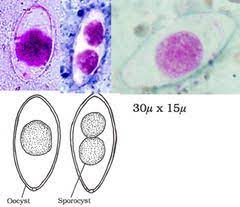 Parasitology Class Id Pictures Names Only Flashcards Flashcards Medical Laboratory Science Study Tools