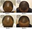 Receding Hairline Men Haircuts