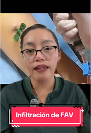 Fístula Arteriovenosa: Infiltración y Nefrología