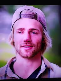 Micah Plath's nose after reconstructive surgery