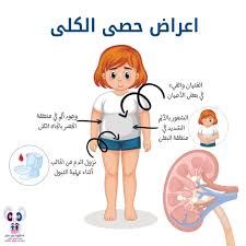 عيادة أمراض الكلى والمسالك البولية للأطفال د عبير عليان Posts Facebook